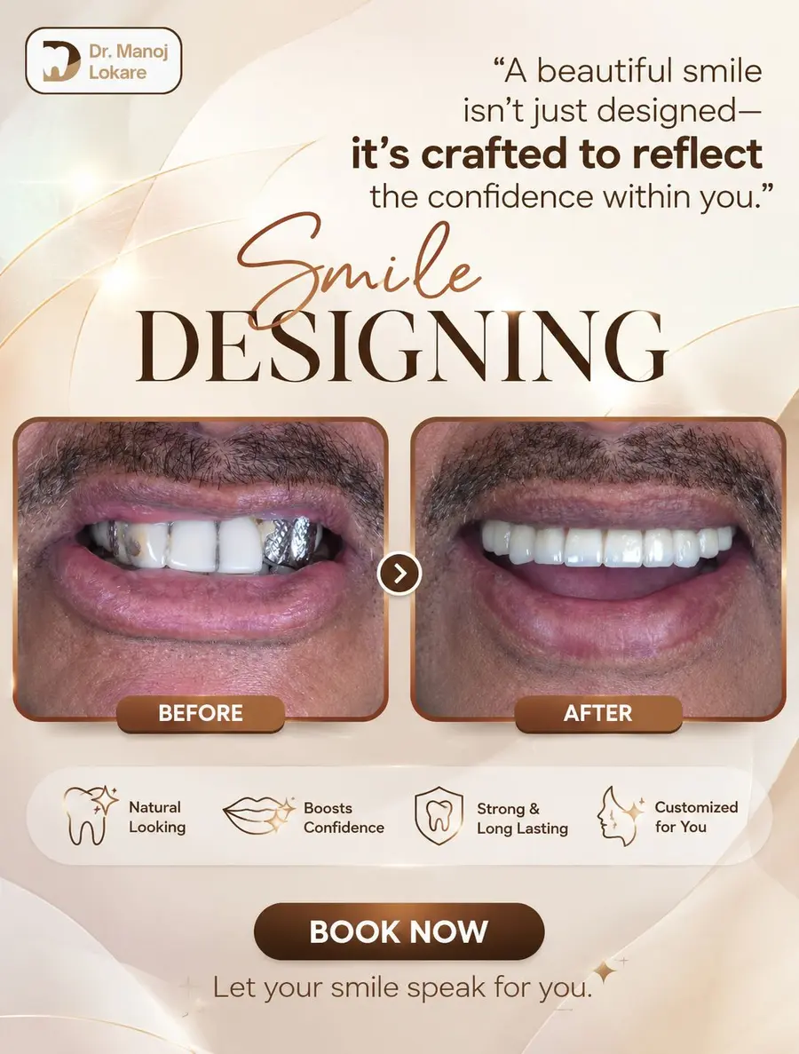 Dent-Ace smile design before and after transformation
